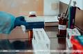 В Беларуси выздоровели и выписаны 10 620 пациентов с COVID-19